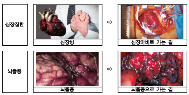 "성기능 장애로 가는 길"…담뱃갑 포장지 `더 살벌하게`